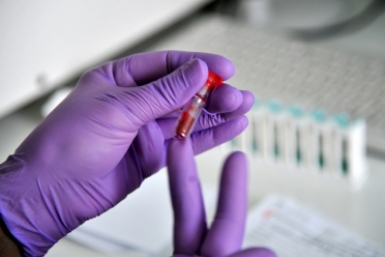 Тест на ВПЧ включат в бесплатную диспансеризацию для женщин Юрий Гуршал, ИА SakhalinMediа