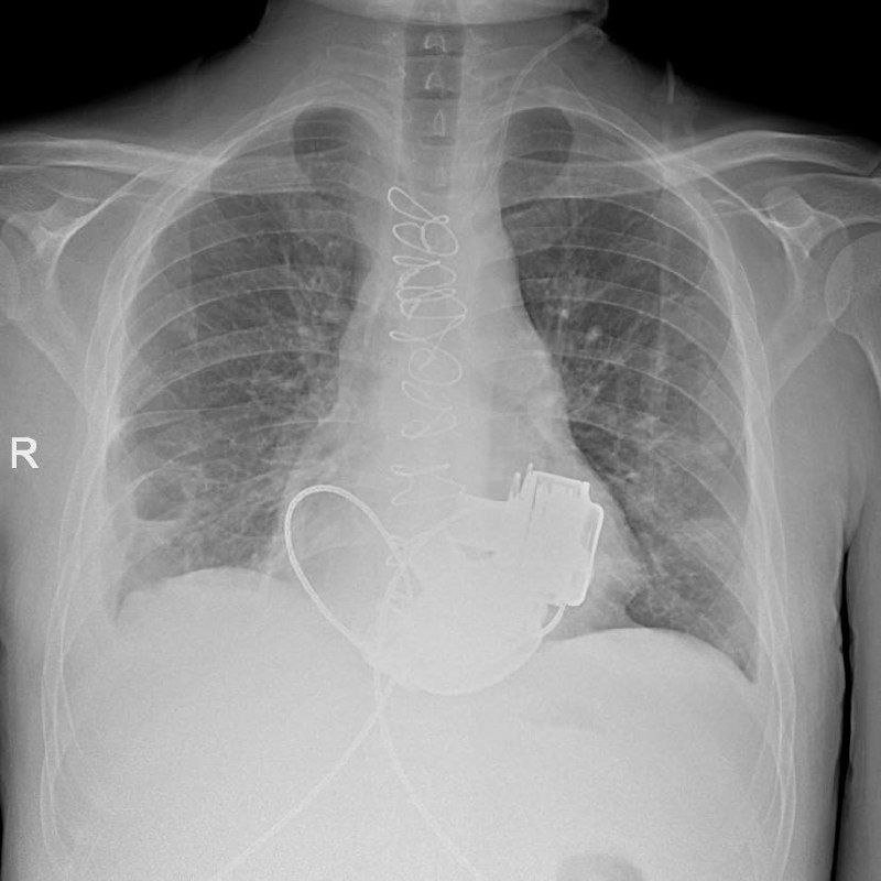 Телеграм-канал Маринской больницы